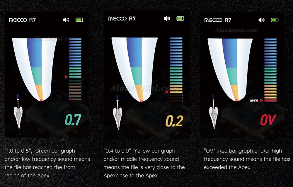 Mecoo R7 Dental Foldable Dental Apex Locator with 3.5 inches TFT Screen